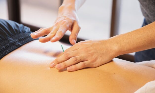 What Acupuncture Is Made For And How It May Help