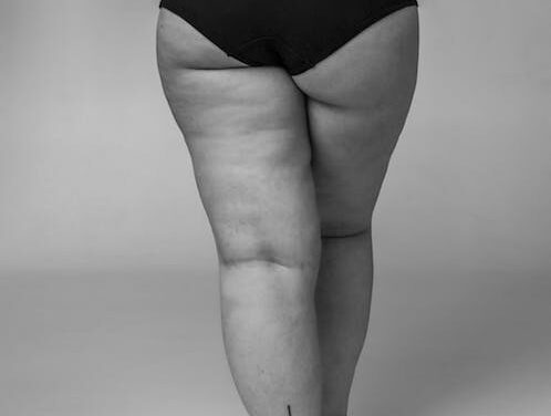 Cellulite Is Not Really One thing That’s Hard To Defeat